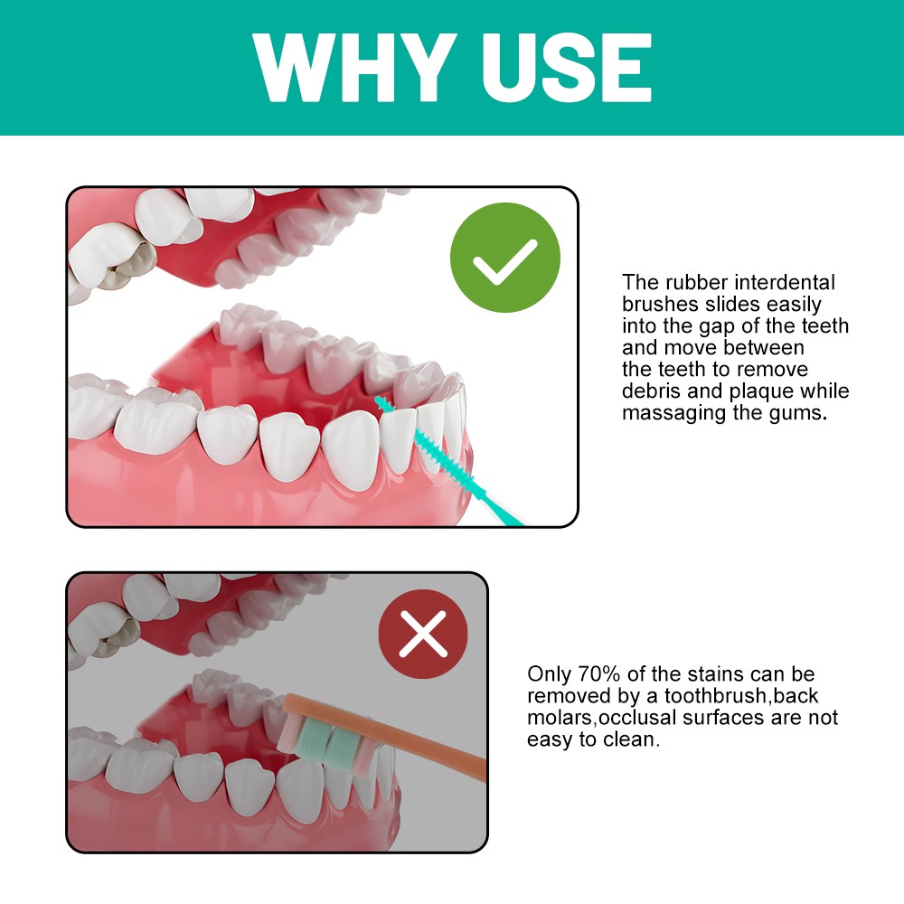 Customized Logo Disposable Dental Cleaning Interdental Brush Toothpick