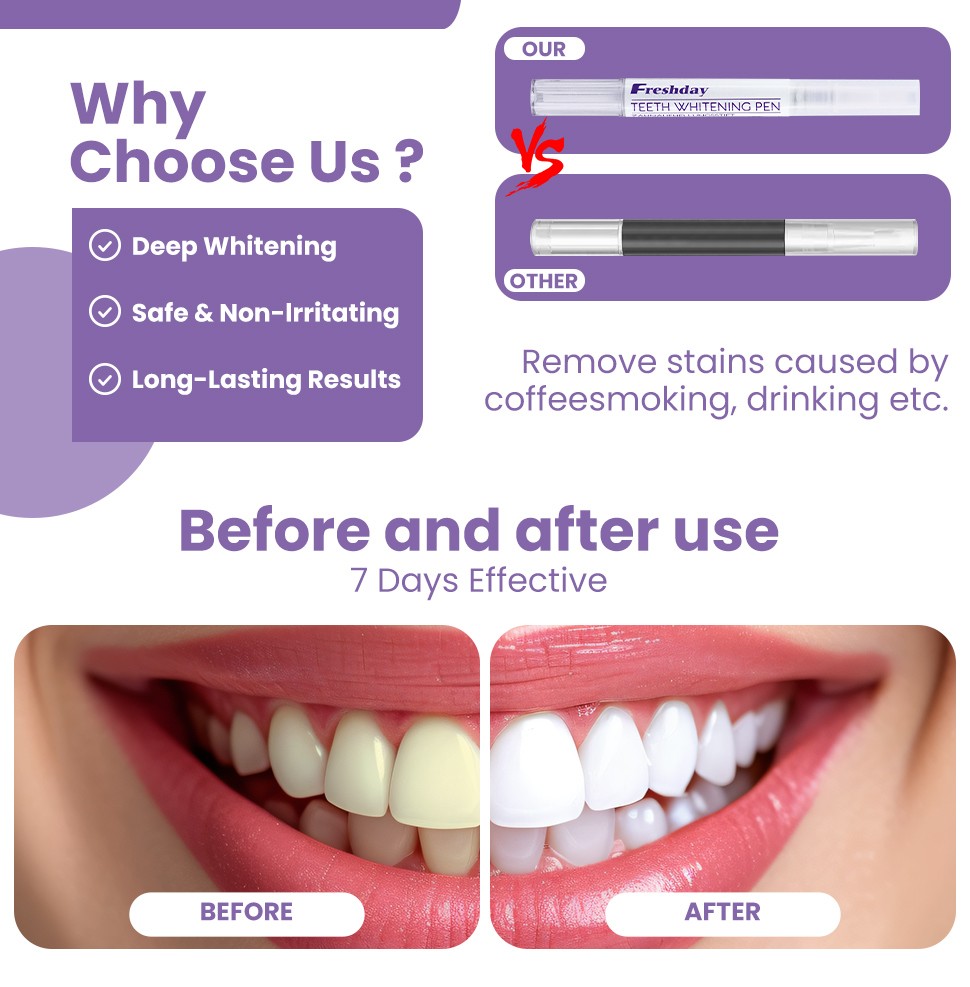 Whitening Teeth Pencil Bleaching Dental Plaque Whiten Teeth Tooth Stain Removal Pen
