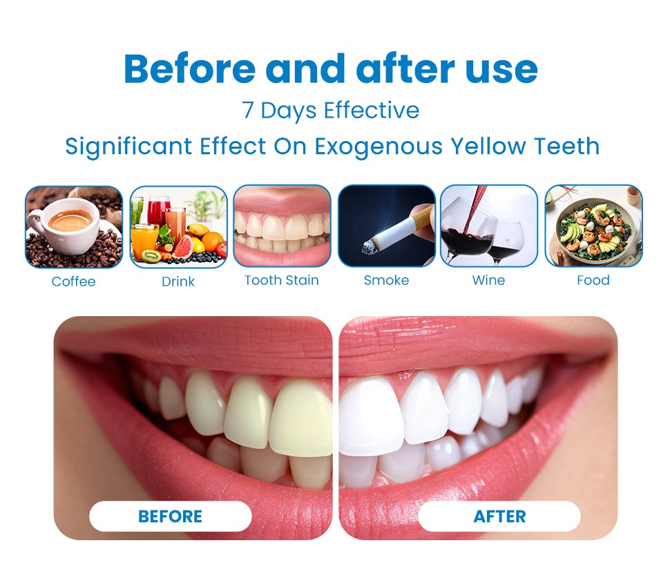 Dazzling White Instant Teeth Whitening Peroxide Pen Bleaching with Logo