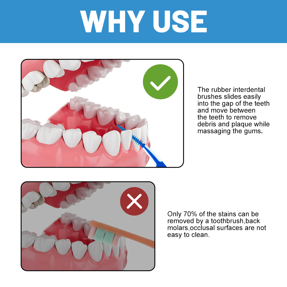 OEM/ODM Customizable Soft Silicone Interdental Brushes Wholesale Dental Picks for Oral Care